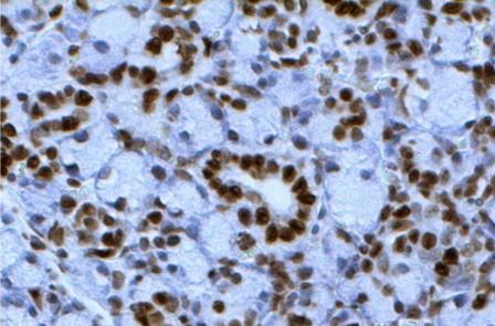 TUNEL Chromogenic Apoptosis Detection Kit